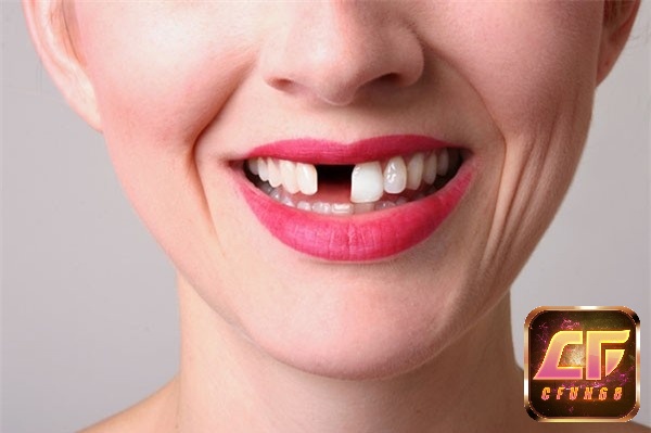 Mơ thấy rụng răng là điềm tốt hay xấu