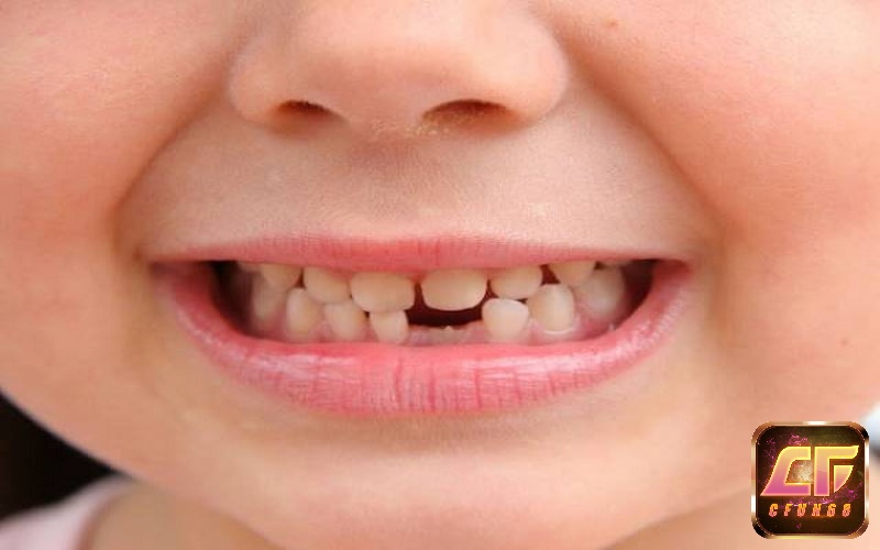 Những giấc mơ thấy rụng răng mang theo ý nghĩa gì?